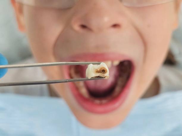 Best Emergency Dentist for Knocked-Out Tooth in Orangeburg, NY